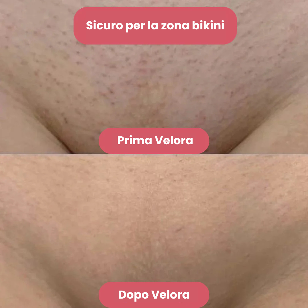 Velora™ - Rasoio 2 in 1