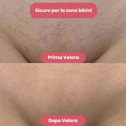 Velora™ - Rasoio 2 in 1